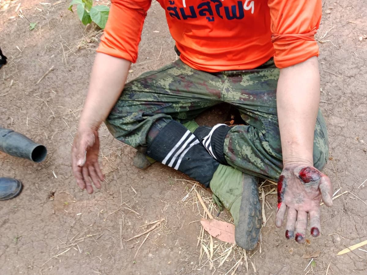 ภาพอาสาสมัครได้รับบาดเจ็บ