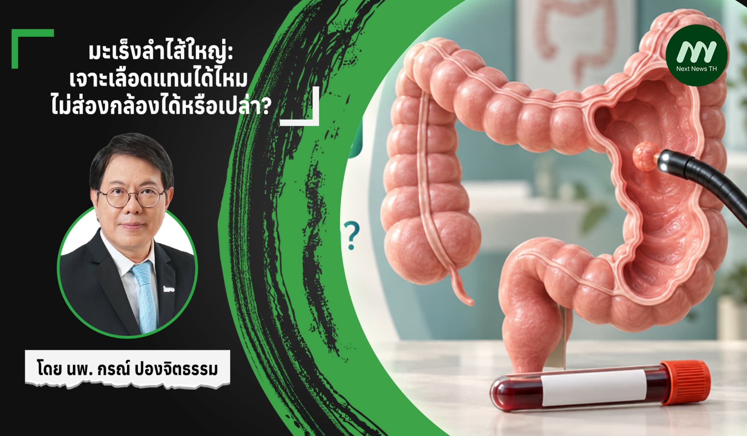 มะเร็งลำไส้ใหญ่: เจาะเลือดแทนได้ไหม ไม่ส่องกล้องได้หรือเปล่า?